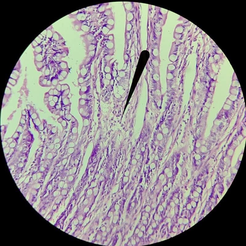 Oprema za laboratorijski mikroskop pomoćna sočiva za mikroskop Uplan FLN fluorescentni cilj 4/5 X1 / 36 vijak 4X 10x 20x 40x 100x